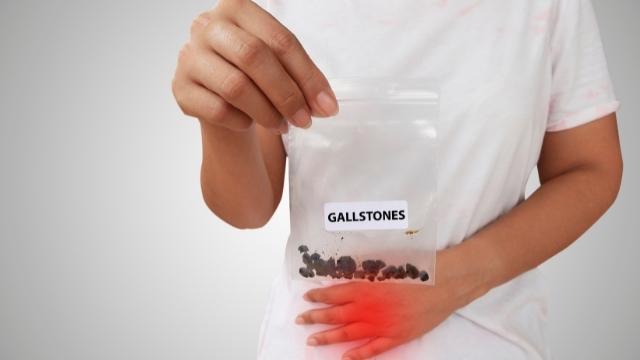 stones in gallbladder