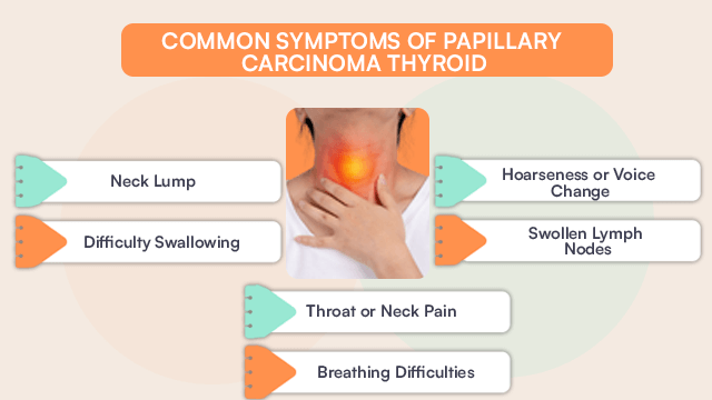 Symptoms of papillary carcinoma thyroid