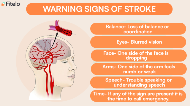 Warning Signs Of A Stroke